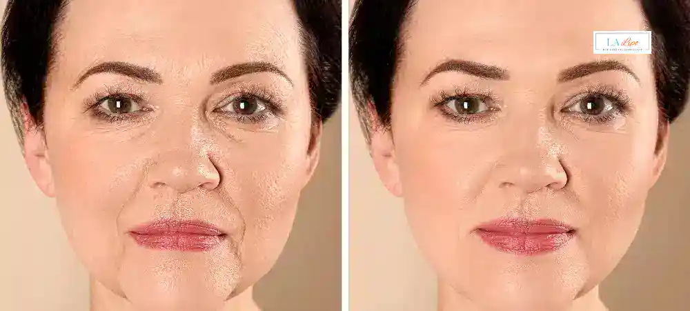 Why Aren’t My Skincare Products Making My Sagging Skin Look Firmer Yateley?