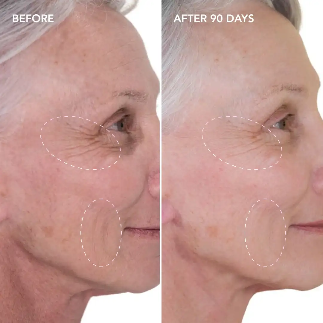 When will you see results Yateley